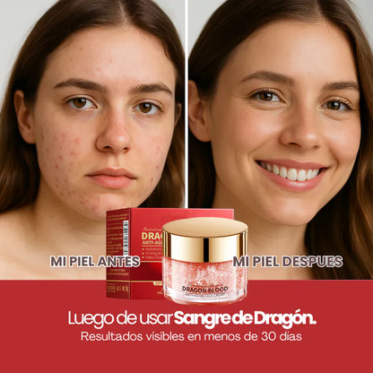 Pack Sangre de Dragón Crema Hidratante (2x1 + Serum GRÁTIS) ¡¡OFERTA BLACK FRIDAY!!